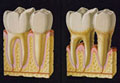 歯槽膿漏歯周病治療マグネシウム歯磨き粉p